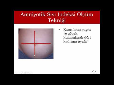 Video: Bipolar Hastalığı Olan Aile Üyeleriyle Nasıl Başa Çıkılır: 14 Adım