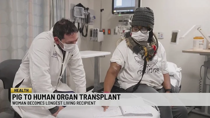 Woman becomes longest living pig organ transplant recipient