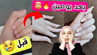 خلطه بمكون واحد فقط لتطويل الاظافر في يوم واحد و تبيضها || عن تجربة حقيقيه بالدليل ?? || منة يسري ?