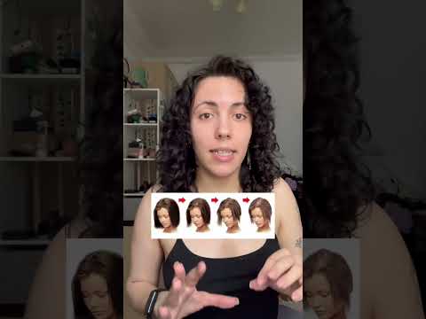 Как отличить андрогенную