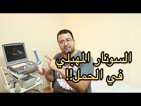 فيديو: هل التنظير المهبلي آمن أثناء الحمل؟