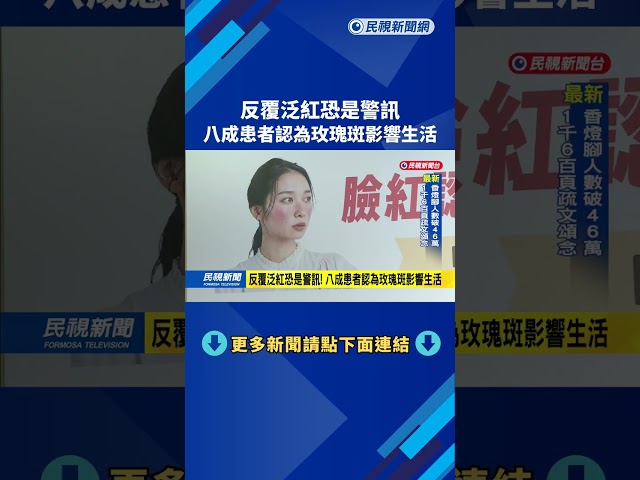 反覆泛紅恐是警訊！ 80%患者認為玫瑰斑影響生活－民視新聞