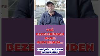 YAĞ BEZELERİNDEN NASIL KURTULDUM ? #yağbezeleri #yağbezesi #lavantaçayı #shorts #