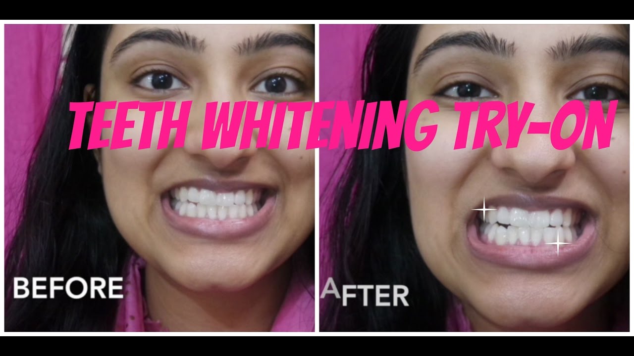 TEETH WHITENING TRYON YouTube