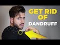 HOW TO GET RID OF DANDRUFF | Men’s Hair | Alex Costa