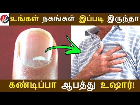 உங்கள் நகங்கள் இப்படி இருந்தா கண்டிப்பா ஆபத்து உஷார்!  | Tamil Cinema