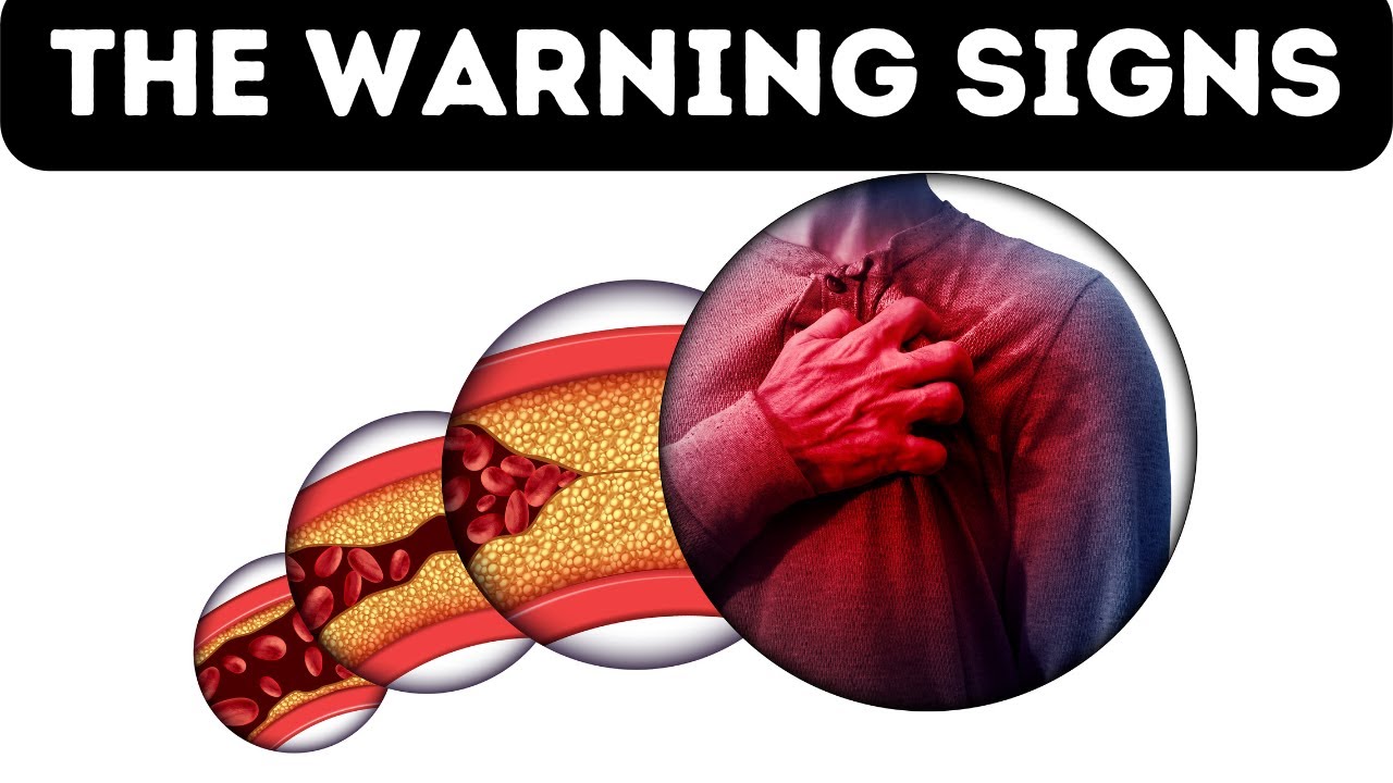 Are You Ignoring the Warning Signs? 15 Signs of an Unhealthy Heart