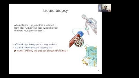 Deep Learning Improves Pancreatic Cancer Diagnosis Using... - Ali Al-Fatlawi - SCS - ISMB/ECCB 2021