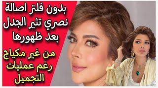 Assala Nasri sparks controversy after appearing without a filter or makeup despite cosmetic surge...