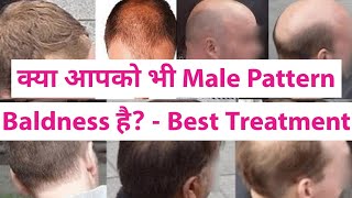 What is Male Pattern Baldness? - What is DHT? - Natural Cure, Treatment & Home Remedies in Hindi