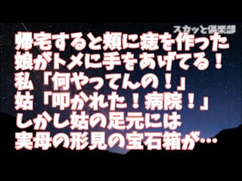 【修羅場】帰宅すると頬に痣を作った娘がトメに手をあげてる！私「何やってんの！」姑「叩かれた！病院に行くからな！」しかし姑の足元には実母の形見の宝石箱が叩きつけられるように壊れて転がっていて…
