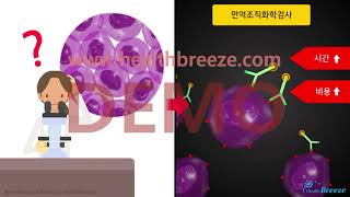 [시연용] b0057aako_유방 중심부침생검 안내 (유방조직검사)