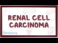 Renal cell carcinoma - causes, symptoms, diagnosis, treatment, pathology