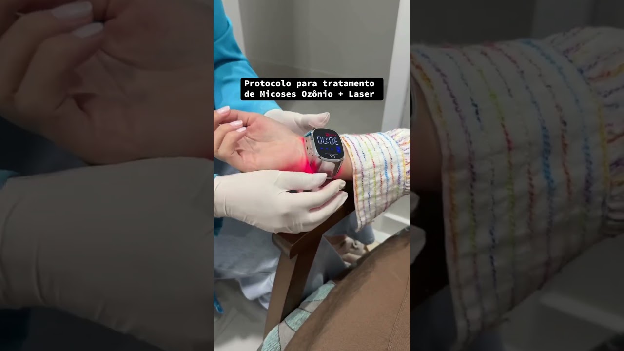 Podologia no Centro de São José dos Pinhais - PR | Marafigo Clínica Integrativa