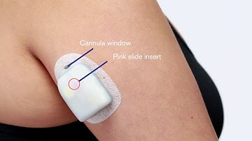Inserting the Cannula - The Omnipod® System