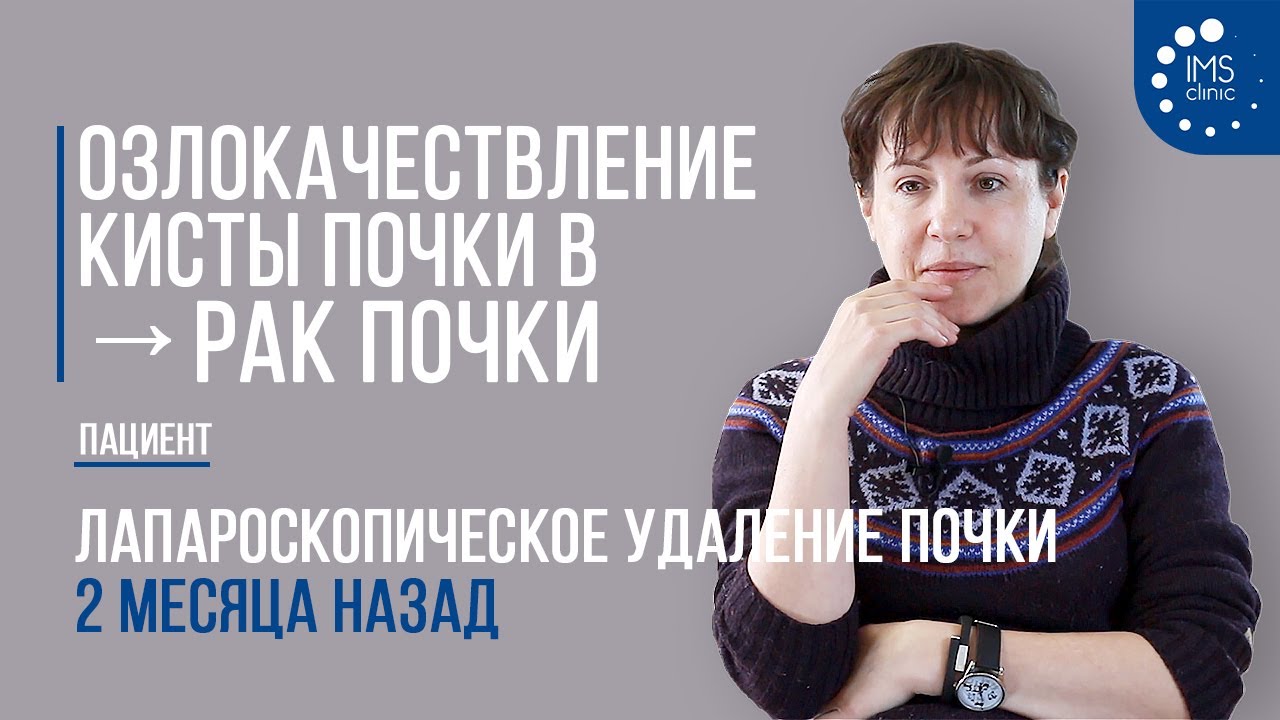 Озлокачествление кисты почки в рак почки. Лапароскопическое удаление почки 2 месяца назад