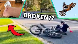 Broken Ankle? Compound Supercross