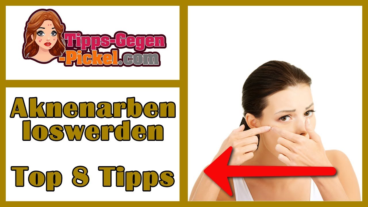 Aknenarben Loswerden Top 8 Tipps Youtube