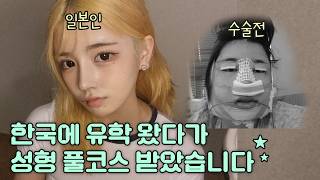 한국 사람들 다 이렇게 성형해요? 혼또니...? [일본인사야Vlog]