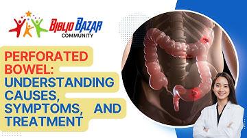 🩺 Understanding Perforated Bowel: Causes, Symptoms, and Treatment Explained 🚨