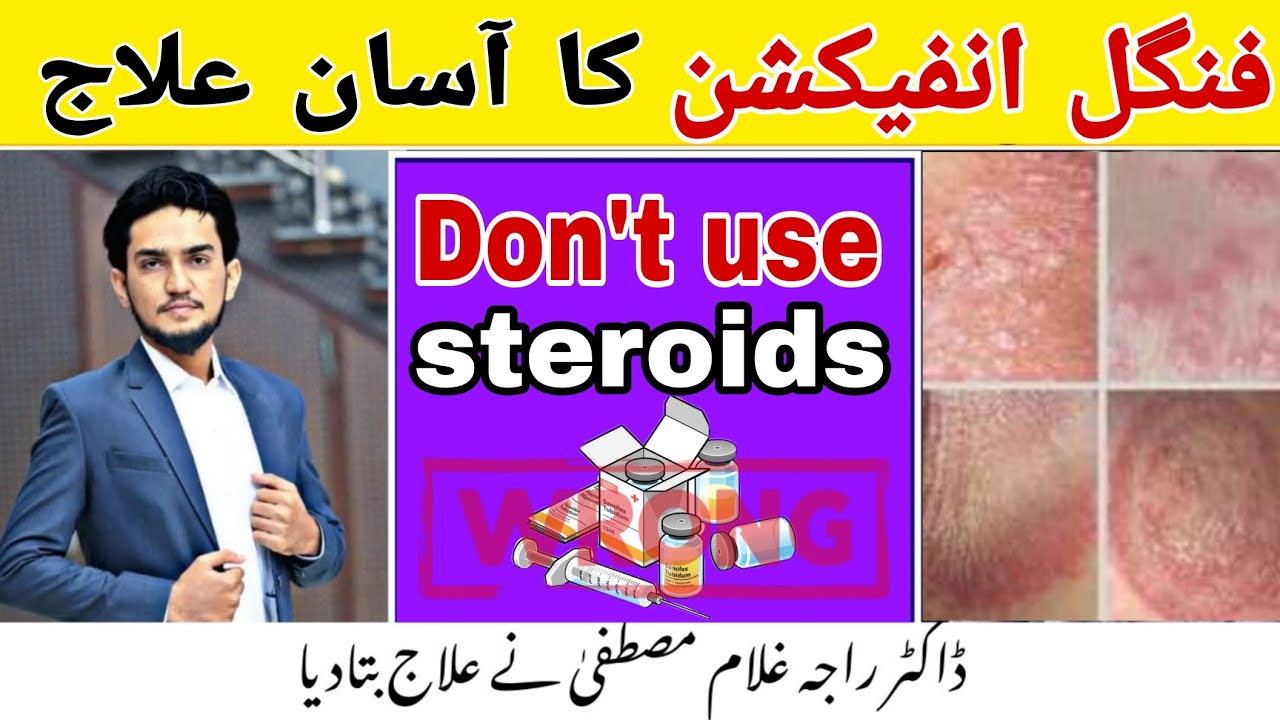 Fungal Infection Treatment in Homeopathy | Best Remedies by Dr. Raja Ghulam Mustafa