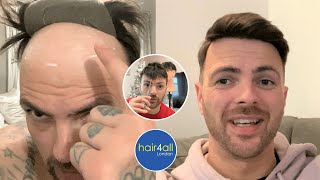 How To Cut a Hair System! Before & After | Non-Surgical Hair Replacement System Men/Women | UK/USA