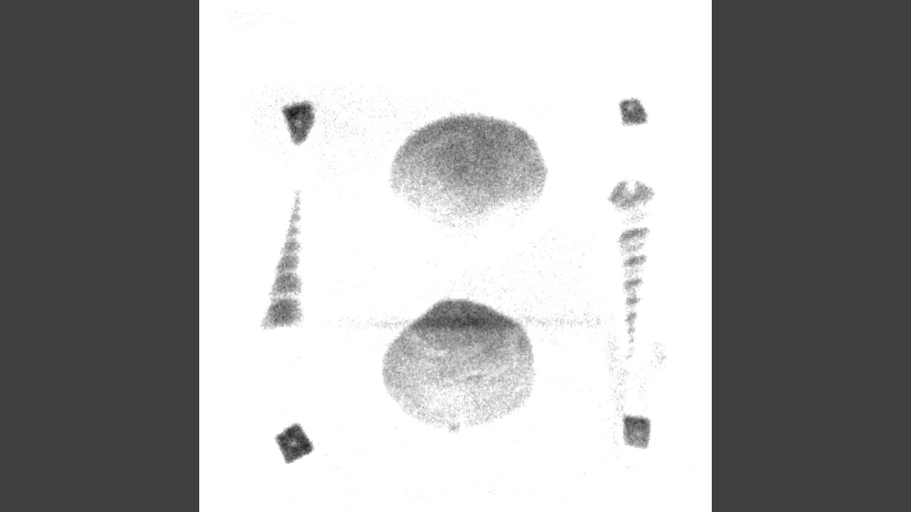 Watch Jerry on YouTube Watch Jerry on YouTube