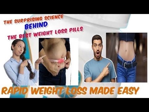 Revision Weight Loss Surgery Pt 2