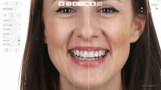 3.21 - 3Shape - Smile Design With - RealView Engine Design Wealth