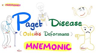Paget Disease of Bone (Osteitis Deformans) | with a Mnemonic