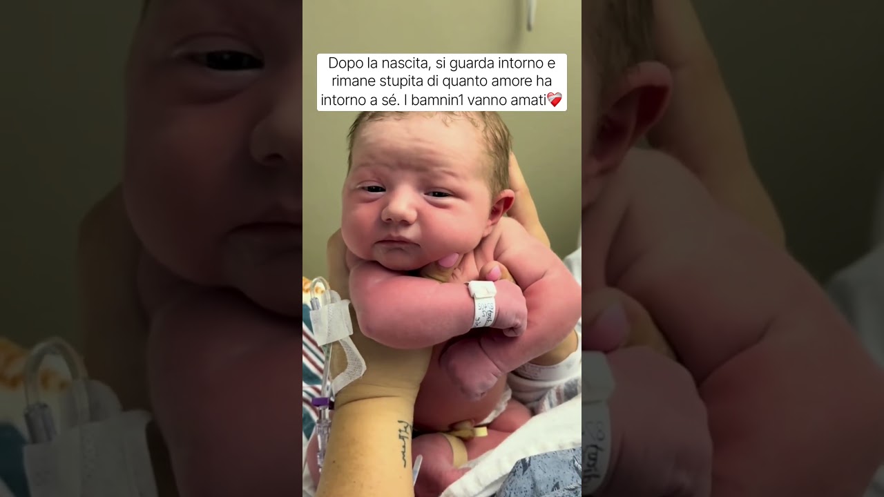 Dopo la nascita, si guarda intorno e rimane stupita di quanto amore ha intorno a sé ❤️🩹 bekijken op YouTube Dopo la nascita, si guarda intorno e rimane stupita di quanto amore ha intorno a sé ❤️🩹 bekijken op YouTube
