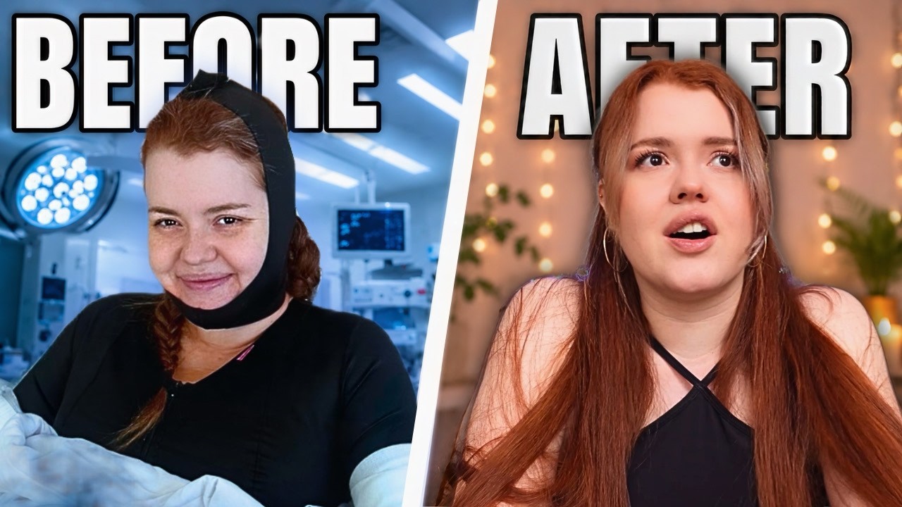 The TRUTH about my first surgery