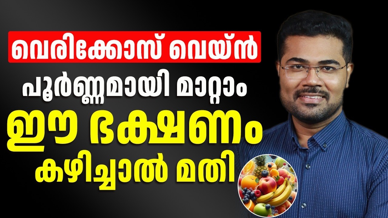 ഈ ഭക്ഷണം കഴിച്ചാൽ വെരികോസ് വെയ്ൻ പൂർണമായി മാറ്റം ¦ dr manoj johnson