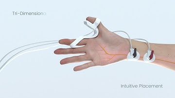 IDMED ToFscan | 3D Medical Device Animation by KALEIDOSKY STUDIO