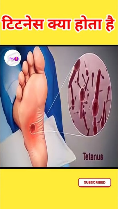 टिटनेस बहुत ही खतरनाक होता है | #shorts | #youtubeshorts | #shortsvideo