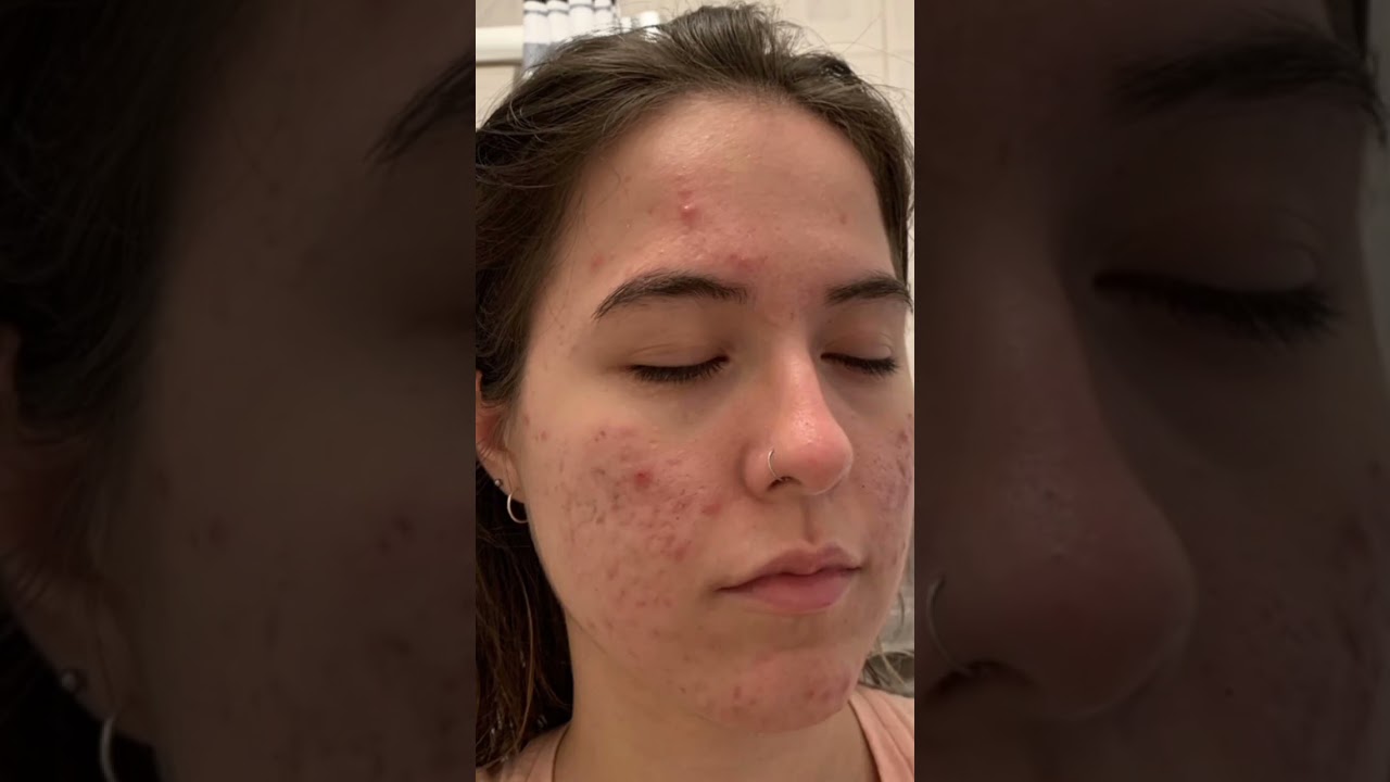 maxdif skin brightening cream | skin brightening review | maxdif review | maxdif cream |