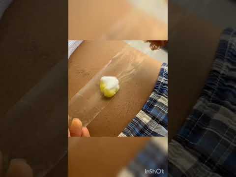 فواید چرب کردن ناف با روغن زیتون سلامتی روغن زیتون طب طبیعی درمان سنتی ناف درمانی زیبایی پوست