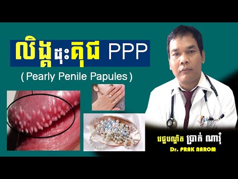 លិង្គដុះគុជ PPP-Pearly Penile Papules