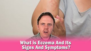 What is Eczema And Its Signs And Symptoms?