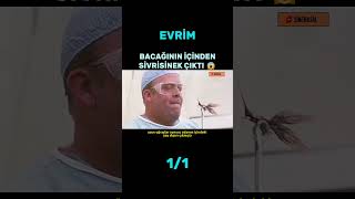 Bacağından Sivrisinek Çıkardı 