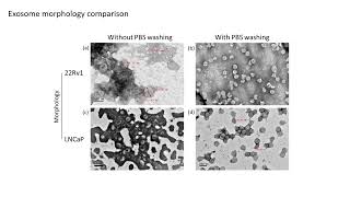 ProteiNext Symposium: Characterization of Prostate Cancer Cells Derived Exosomes