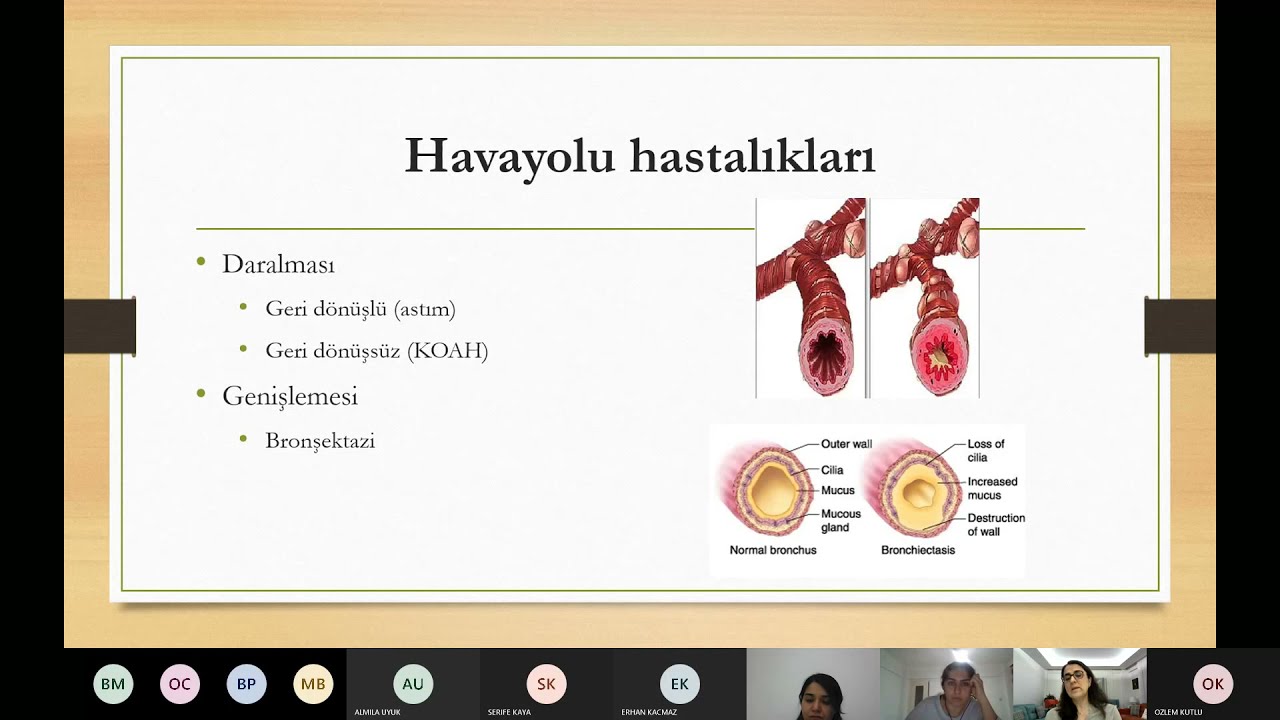 Olgularla havayolu hastalıklarına yaklaşım-02042021-Prof. Dr. Göksel Altınışık Ergur