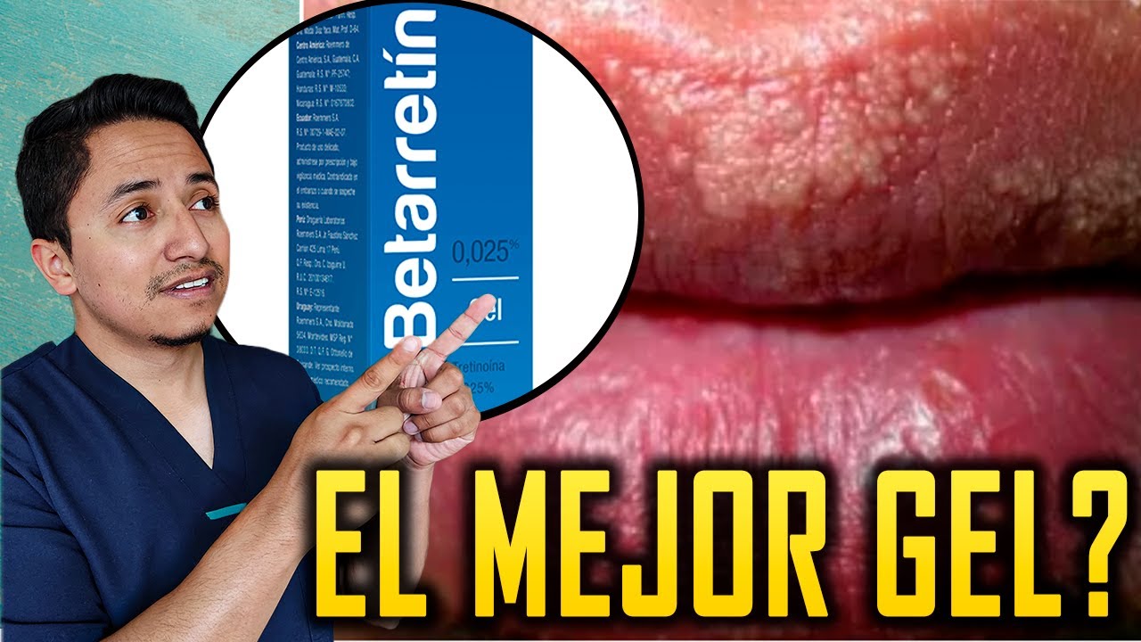 ¡Mira Esto! Antes de Usar la TRETINOINA para Remover los GRANOS de