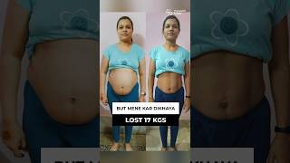 17 Kgs Belly Fatloss Breastfeeding Mom