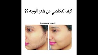 ازالة شعر الوجه؟!!Facial hair removal