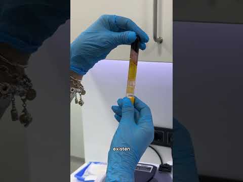 Dolor en la vejiga pero análisis normales | ROC CLINIC