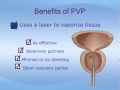 Photoselective Vaporization of the Prostate (PVP) Laser Therapy for BPH