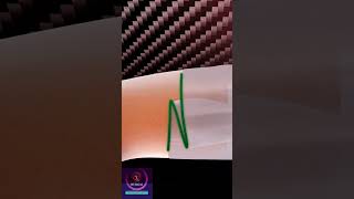 Wound Healing - Negative Pressure Therapy