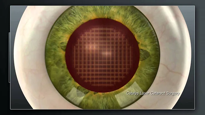 WDAM Health Connections - Hattiesburg Eye Clinic -...