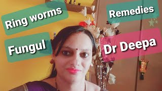 Fungal and Ringworm infections | Remedies  in  hindi